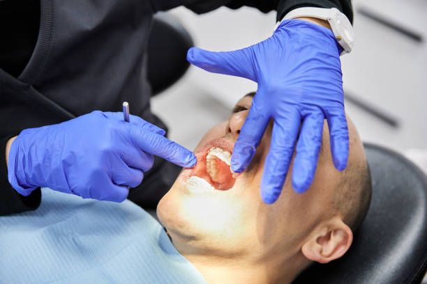 Best Emergency Dental Care for Broken or Chipped Teeth in Sylacauga, AL