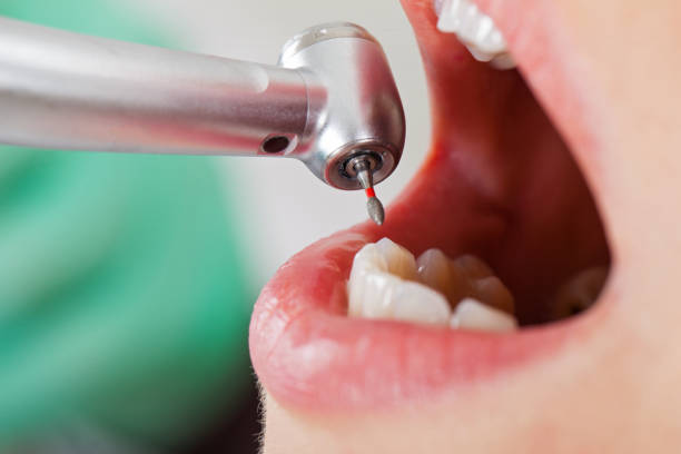 Best Pediatric Emergency Dentist in Sylacauga, AL